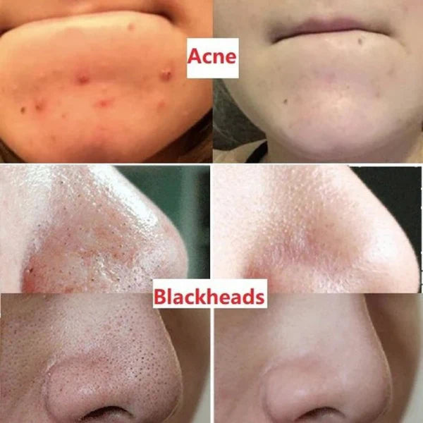 Fresh Gloss Complete Skin Renewal Duo